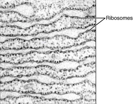 Squiggly lines studded with ribosomes.
