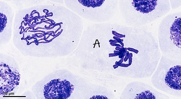 A cell with condensed chromosomes, each containing two chromatids. The chromosomes seem to be gathering at the center of the cell.