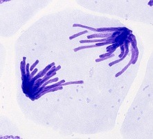 A cell showing chromatids moving away from the center of the cell.
