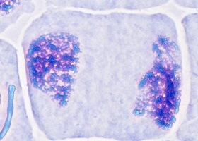 A cell with genetic material at two ends. The DNA looks like chromatin.