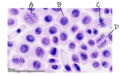 A picture of cells in various phases of the cell cycle.
