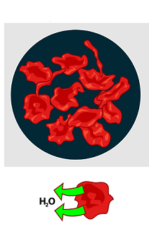 Blood cells are in a solution. They are all shriveled up and wrinkly. There are arrows pointing out of the blood cells labeled "Water".