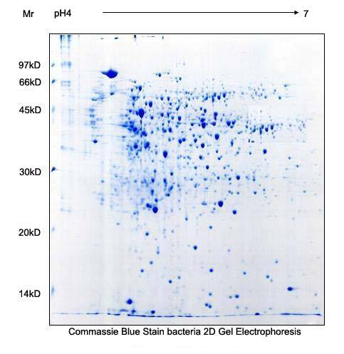 Commassie blue stain bacteria 2D Gel Electrophoresis