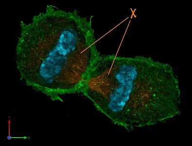 A cell in telophase