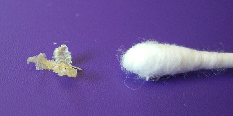 Dried earwax next to a cotton swab
