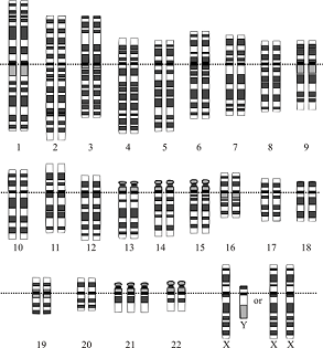 Each of the chromosome pairs of a human genome are shown. There are two copies of chromosomes 1-20. Chromosome 21 has three, while chromosome two has two. The sex cells are shown as xy and xx. 
