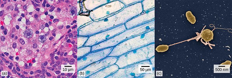 Picture A is multicellular and made of round cell that are about 10 micrometers in diameter.
Picture B shows a multicellular organism with square cells about 50 micrometers in diameter.
Picture C is unicellular and about 500 nanometers in diameter.