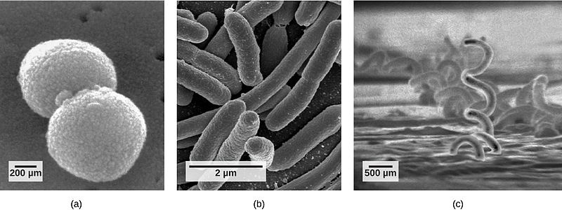 Picture A shows round cells that are 200 micrometers large. Picture B shows tube like cells that are two micrometers large.  Picture C shows curly cells that are about 500 micrometers large. 
