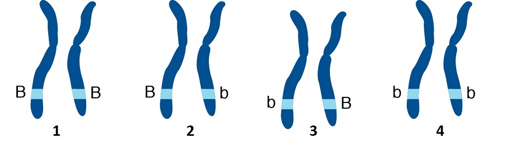 This picture shows four sets of chromosomes and their alleles for gene B. The first chromosome has two capital B alleles. The second has one capital B and one lowercase b allele. The third has one lowercase b and one uppercase B allele. The fourth has two lowercase b alleles.