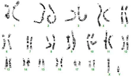 A diagram showing all the pairs of chromosomes that a certain person has.