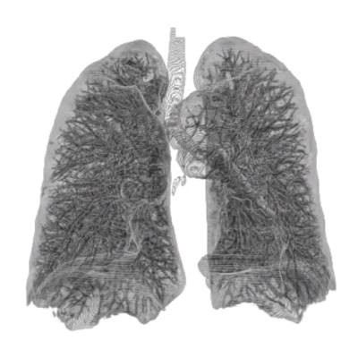 Picture of lungs.
