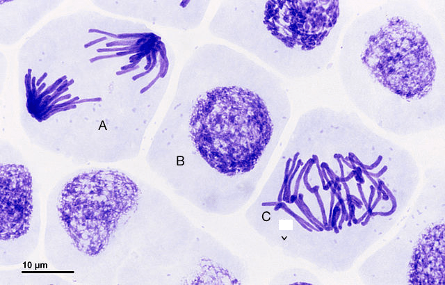 cell A- sister chromatids on opposite sides of cell, cell B- no distinction of chromosomes, cell C- chromosomes lined up in middle of cell, sister chromatids not yet separated