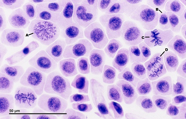 Cell A has DNA that is starting to coil. B has two separate nuclei, and C has chromosomes lined up along the metaphase plate.