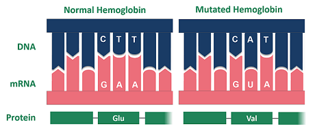 Normal hemoglobin contains the codon CTT which corresponds to the amino acid Glu. Mutated hemoglobin contains the sequence CAT which corresponds to the amino acid Val.