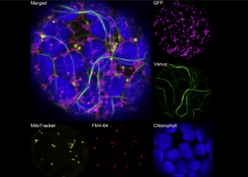 Five color observation of organelles in a plant cell