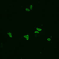 The worms that cause toxoplasmosis