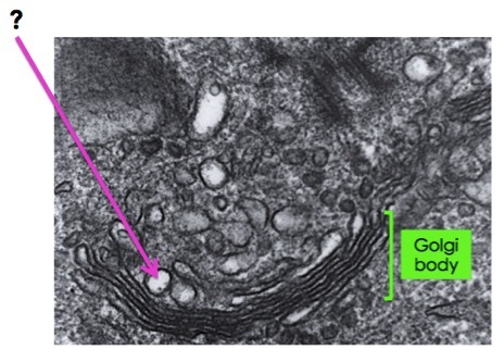 A small circular structure coming off the Golgi body.