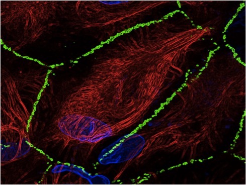 Cells under a microscope. The borders are green and the interior are red. There are circular blue spots, one per cell.