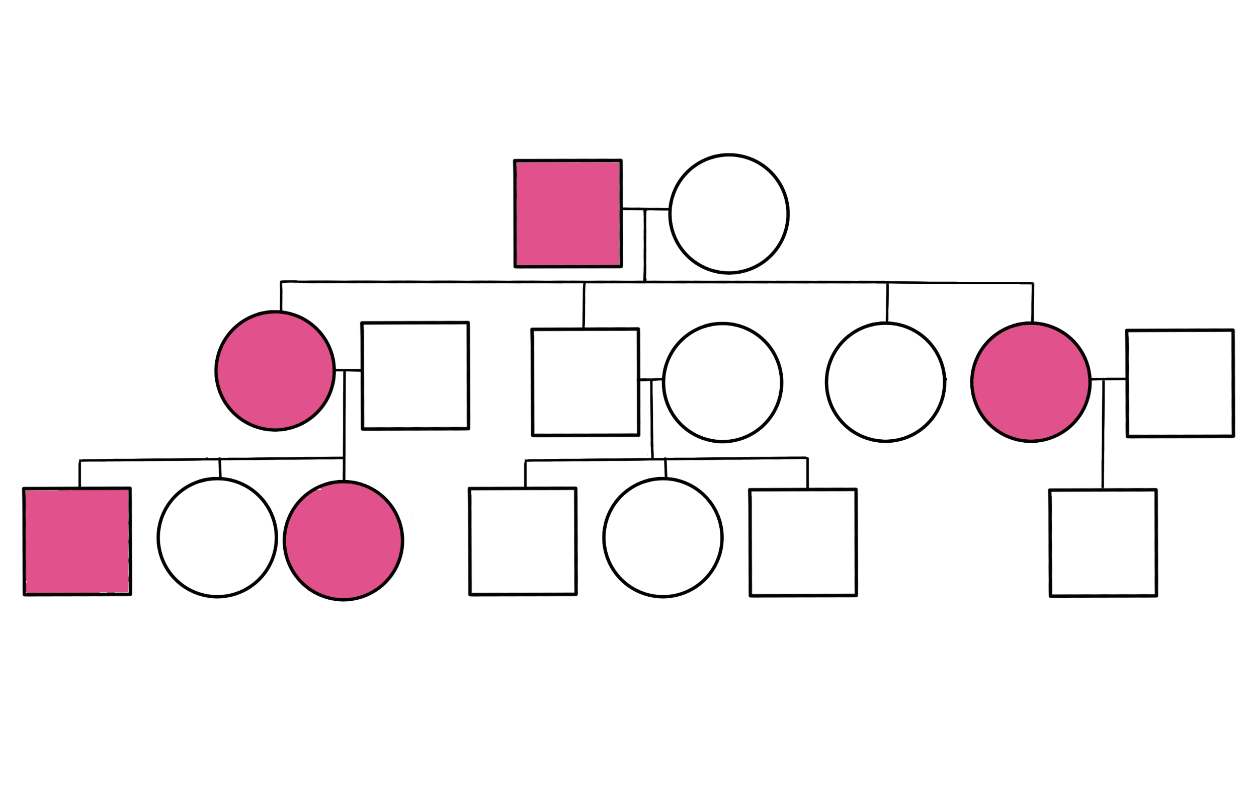 This image shows a pedigree chart. In the first generation the father is affected and the mother is unaffected. They have four children; three girls and one boy. In this next generation two of the daughters are affected and the other two children are not. The second generation has children. One affected daughter had children with an unaffected man. Her son and daughter are affected and her other daughter is not. The other affected daughter has one unaffected son with an unaffected man.  The other children who are unaffected marry and have unaffected children.