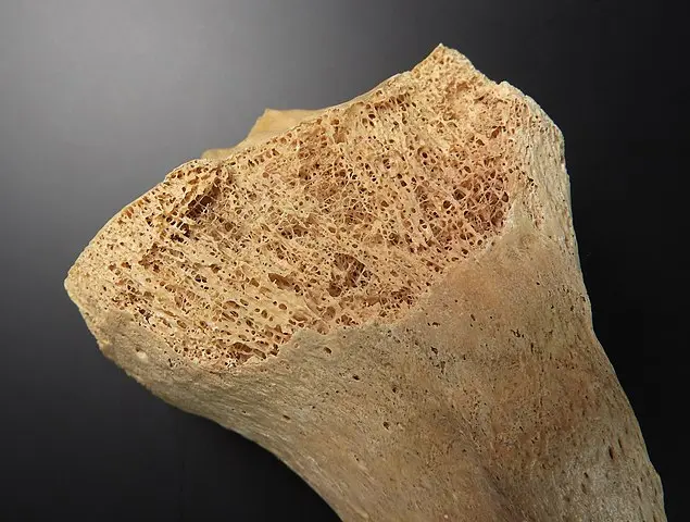 An image of bone tissue (a type of connective tissue) in a human tibia.