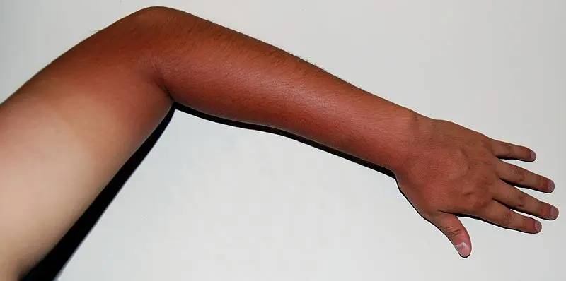 Humans evolved to be able to tan in response to excess sunlight.