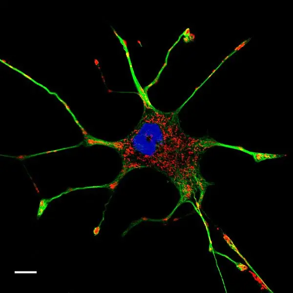 Image of a neuron with actin filaments stained red and microtubules stained green
