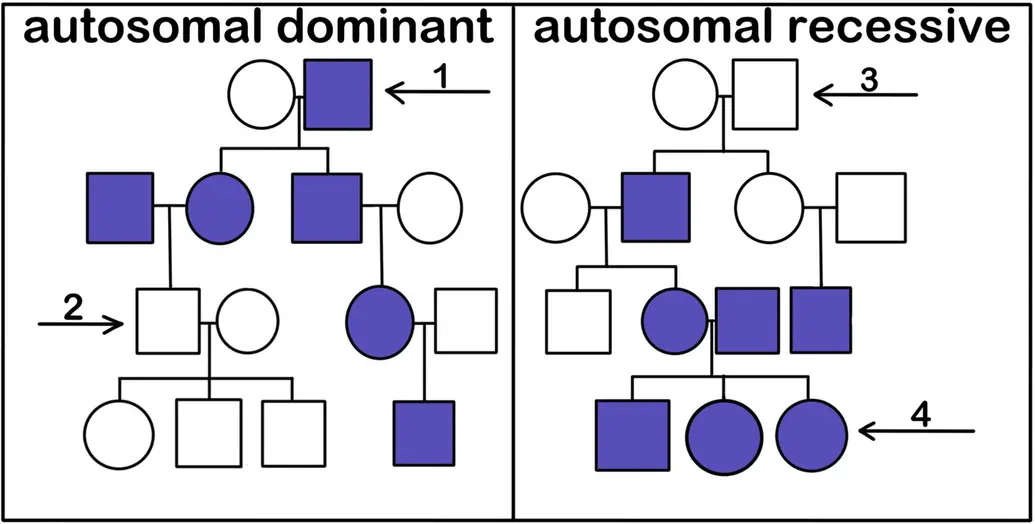 An autosomal-dominant pedigree. There is one affected parent and one unaffected parent. This couple has two affected children. One of those children has an unaffected child who then has kids with another unaffected person. All their kids are unaffected. The other child of the original parents has an affected child with an unaffected person. The child has an affected child with an unaffected person. An autosomal-recessive pedigree starts with unaffected parents who have one affected and one unaffected child. The affected child has children with an unaffected person. Among their children, one is affected and one is unaffected. The affected child has a child with another affected person. All their children are affected. The unaffected child of the first couple has children with another unaffected person. This couple has an affected child.