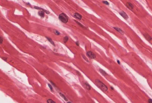 Cardiac tissue where all the nuclei are visible