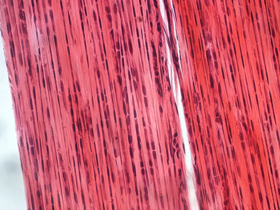 An image of connective tissue where all the nuclei are visible
