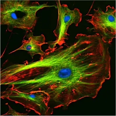 The cytoskeleton extends throughout the cell.