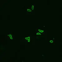 The worms that cause toxoplasmosis