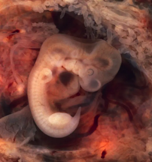 A human embryo